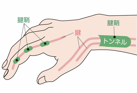 東御市,上田市,小諸市,整体,指圧,ほぐしや,ばね指改善方法