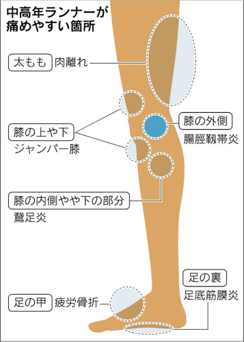 東御市,上田市,小諸市,整体,指圧,ほぐしや,ランニング時の膝の痛み原因と対策