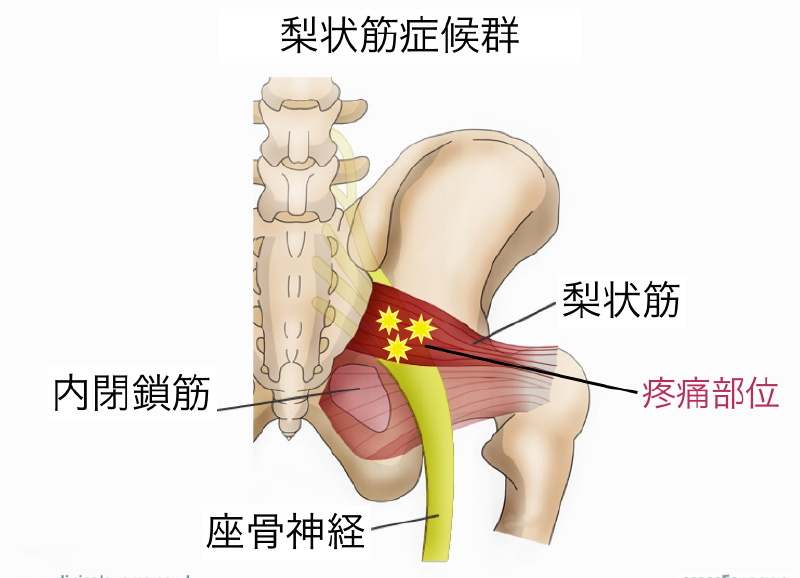 東御市,上田市,小諸市,整体,指圧,ほぐしや,指圧,整体
