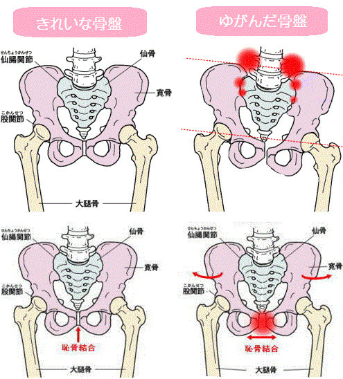 東御市,上田市,小諸市,整体,指圧,ほぐしや産後の骨盤矯正