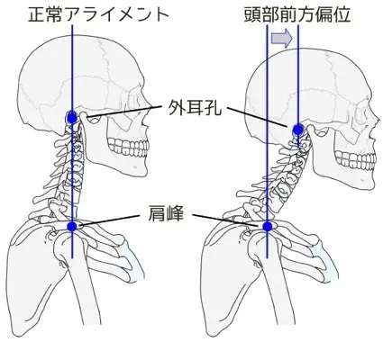 東御市,上田市,小諸市,整体,指圧,ほぐしや,首の体操